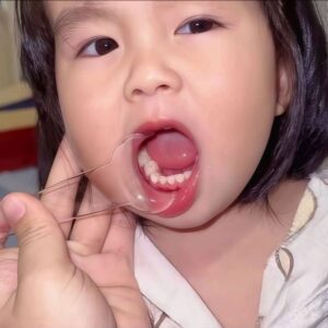 Baby's Toothbrushing Essential - Children's Oral Opening Device, Auxiliary Toothbrush Expander